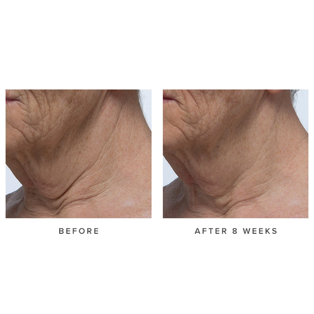 Ageless Revitalizing Neck Cream - Polished Daily Care