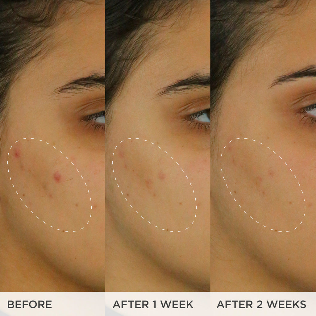 The Brightening Serum - Polished Daily Care