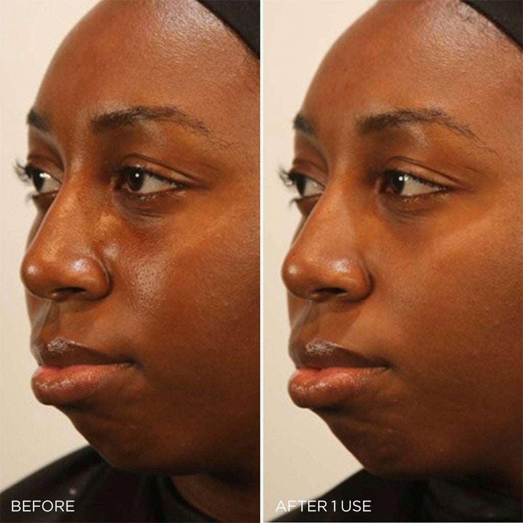 The Clarifying Clay Mask - Smart Routine Choice