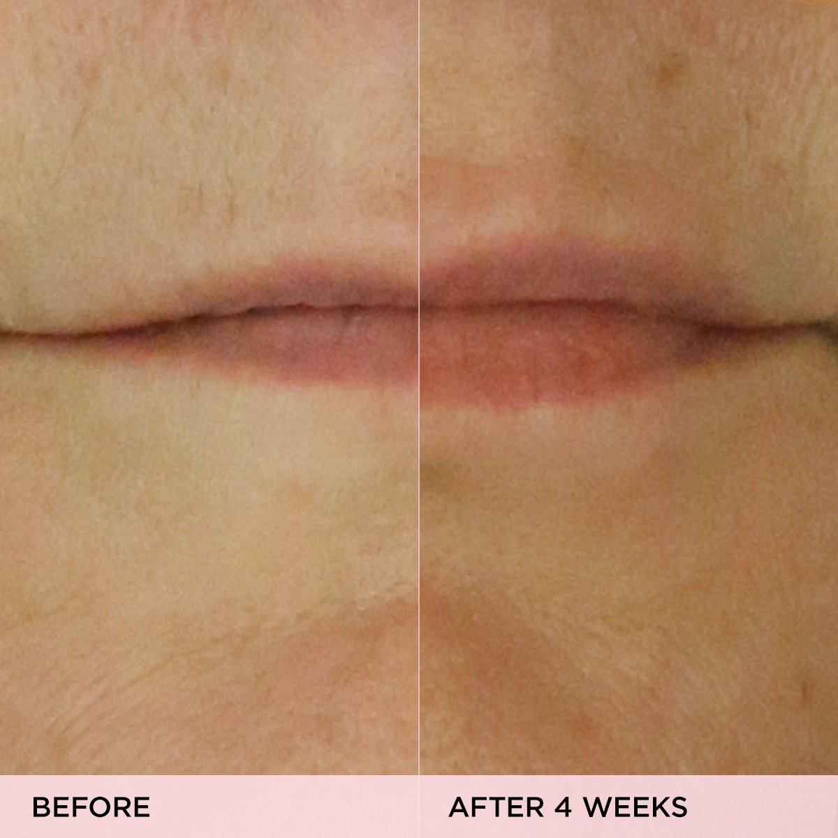 The Kissu Lip Treatment - Polished Daily Care